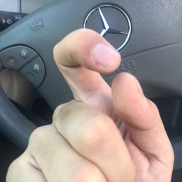 My nail got hurt when he rob my keys. My nail got hurt when he rob my keys.