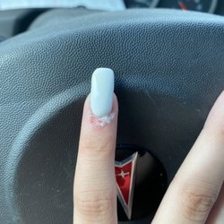 How does my pinky look like this after going to a salon?