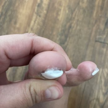 Star Nails - See how thick my nail is the white stuff under my nail is acrylic. - Nail Salons Near Me - Arlington, Texas Star Nails - See how thick my nail is the white stuff under my nail is acrylic. - Nail Salons Near Me - Arlington, Texas