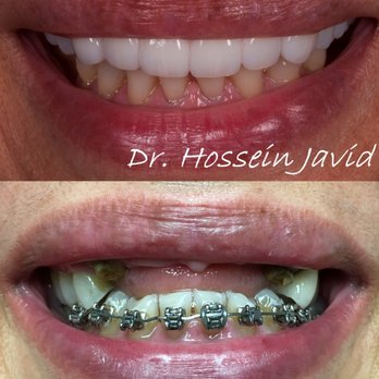 Toothopia Dental - #Anti #Aging #Cosmetic #Reconstruction #Culver City, #Beverly Hills,  # Palms, - Orthodontists Near Me - Culver City, California
