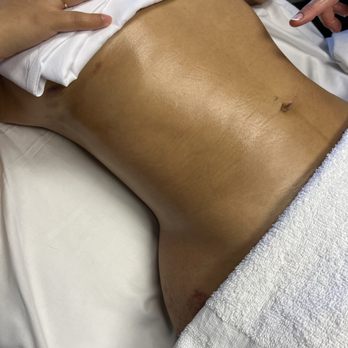 Lymph Bright - Massage Therapy Near Me - Laguna Hills, California Lymph Bright - Massage Therapy Near Me - Laguna Hills, California