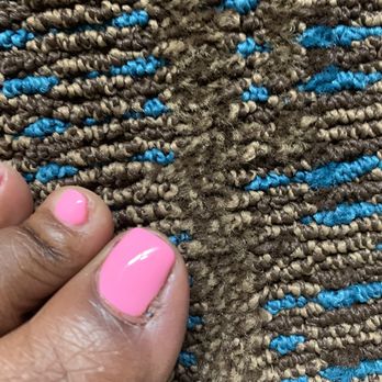 Moon Nails - Scabbed toenail - Nail Salons Near Me - Quincy, Massachusetts
