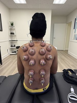 Elevate Spine & Wellness – Cupping Therapy - Elevate Spine & Wellness offers expert cupping therapy designed to relieve tension, improve circulation, and promote overall wellness. Our certified practitioners tailor each session to your unique needs, blending traditional techniques with a modern approach for optimal results. Whether you're seeking pain relief, stress reduction, or enhanced mobility, our tranquil environment ensures a restorative experience that elevates both mind and body. Discover the healing benefits of cupping at Elevate Spine & Wellness—where your well-being comes first. Elevate Spine & Wellness – Cupping Therapy - Elevate Spine & Wellness offers expert cupping therapy designed to relieve tension, improve circulation, and promote overall wellness. Our certified practitioners tailor each session to your unique needs, blending traditional techniques with a modern approach for optimal results. Whether you're seeking pain relief, stress reduction, or enhanced mobility, our tranquil environment ensures a restorative experience that elevates both mind and body. Discover the healing benefits of cupping at Elevate Spine & Wellness—where your well-being comes first.