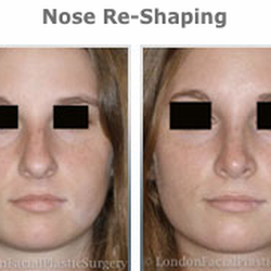 Julian De Silva, MBBS, MD - Rhinoplasty/ Nose Re-Shaping
