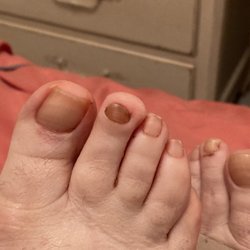 Savannah Nail Bar - savannah nail salon in jupiter, florida. Fungus infection.