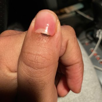 Lee Spa Nails - My thumb after she cut me for the second time - Nail Salons Near Me - Orange City, Florida