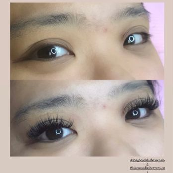 YL beauty - Skin Care Near Me - Lakewood, California YL beauty - Skin Care Near Me - Lakewood, California