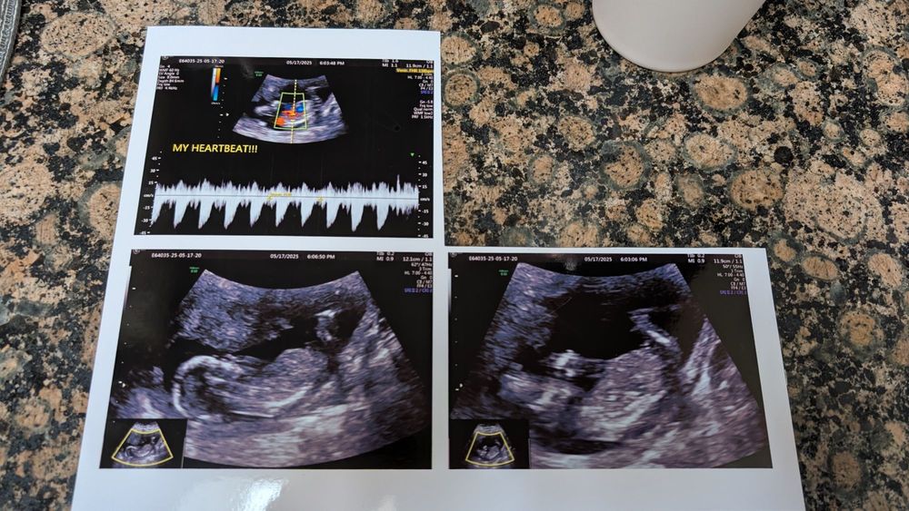 Heavenly 3D 4D Ultrasounds
