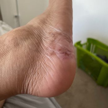Canvas Nails & Spa - Lady cut my foot at the nail spa and I got a foot infection - Nail Salons Near Me - Chandler, Arizona