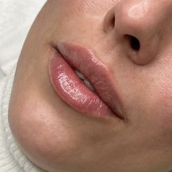 Filler Up Girls - We offer lip filler, cheek filler, jawline contouring, and full facial balancing
Tell us your goal and we'll recommend the best option!