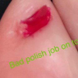 Mont Belvieu Nails Spa - Cut nail too short. Into quick and sloppy polish job. Missing part of nail and painted skin