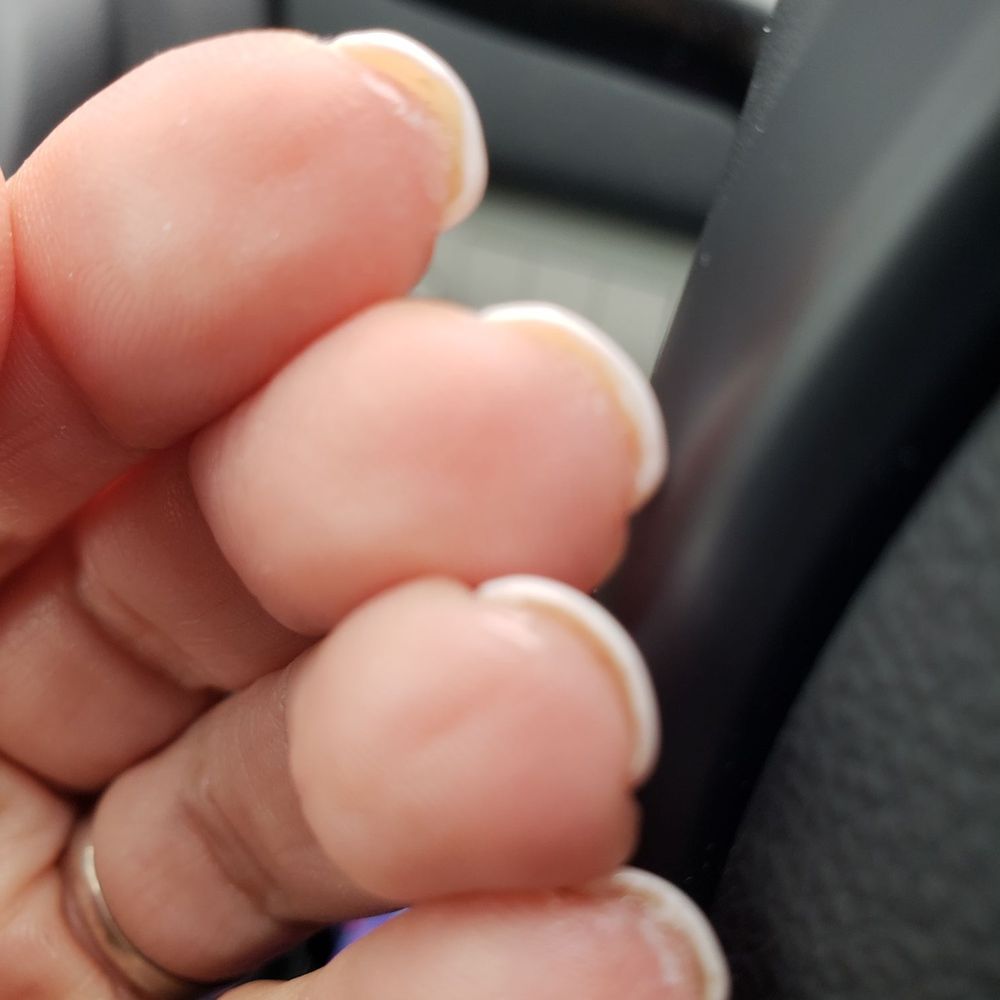 Polish dried on my fingertips Polish dried on my fingertips