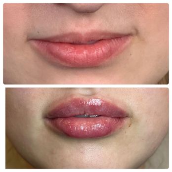 NexGen Aesthetics - Medical Spas Near Me - Swedesboro, New Jersey NexGen Aesthetics - Medical Spas Near Me - Swedesboro, New Jersey