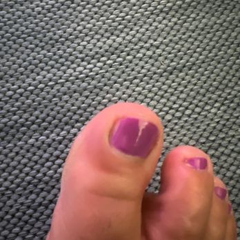 Kim Nails & Spa - Infection and pain on my toe. - Nail Salons Near Me - Delray Beach, Florida Kim Nails & Spa - Infection and pain on my toe. - Nail Salons Near Me - Delray Beach, Florida