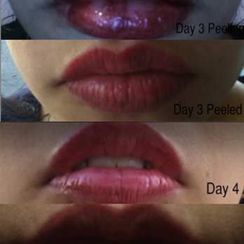 Beverly Hills Permanent Makeup - The process I went through. Peeled completely off day 3 and settled to its actual color after 1 week-2 weeks - Permanent Makeup Near Me - Beverly Hills, California Beverly Hills Permanent Makeup - The process I went through. Peeled completely off day 3 and settled to its actual color after 1 week-2 weeks - Permanent Makeup Near Me - Beverly Hills, California