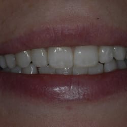 Ambridge Ceramics Dental Laboratory - Natural Smiles