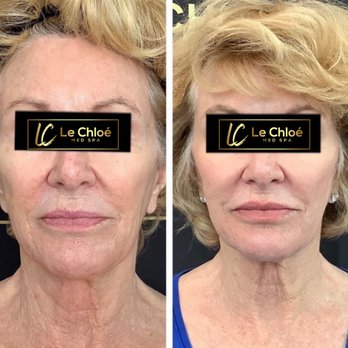 Le Chloè Med Spa - Medical Spas Near Me - Katy, Texas