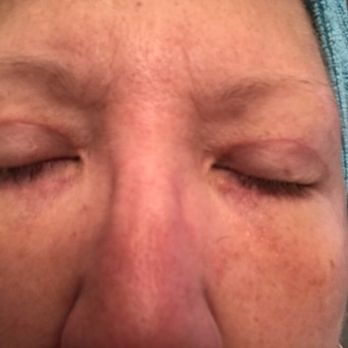 Scott M Gayner, MD - Cosmetic Surgeons Near Me - Harrisburg, Pennsylvania Scott M Gayner, MD - Cosmetic Surgeons Near Me - Harrisburg, Pennsylvania