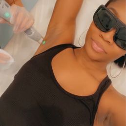 Lasering my armpits Lasering my armpits