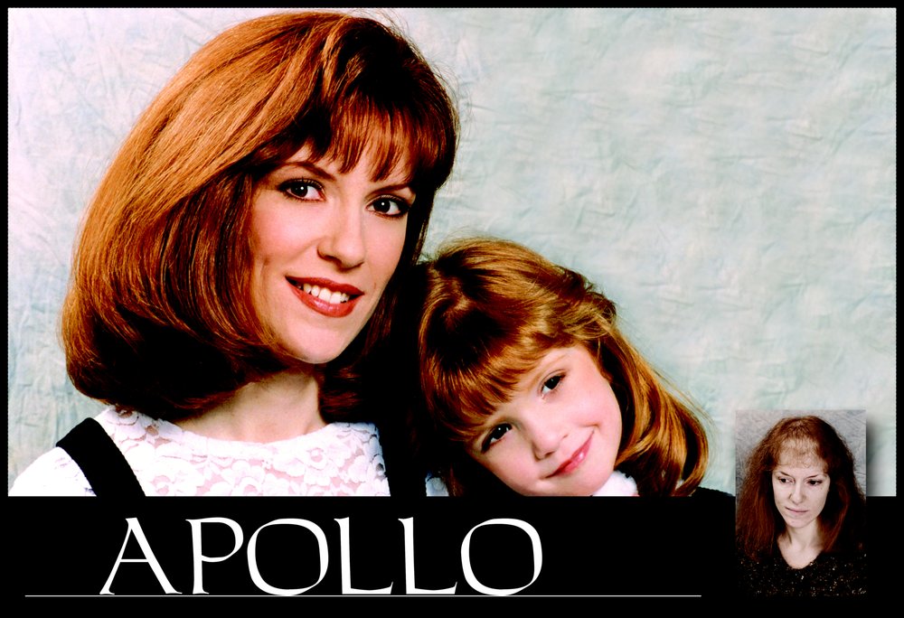 APOLLO HAIR SYSTEMS Updated June 2024 9658 Silvermoon, San Antonio