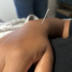 One-Stop Acupunture