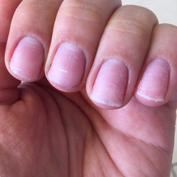 Classy Nails - After having her remove horrible paint job. My index and middle fingers bled because they were filed too low. - Nail Salons Near Me - El Cerrito, California