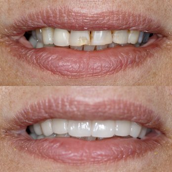 Brentwood Dentistry 40 Photos 104 Reviews General Dentistry