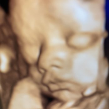 Baby Envision - Amazing features - Diagnostic Imaging Near Me - Troy, Michigan Baby Envision - Amazing features - Diagnostic Imaging Near Me - Troy, Michigan