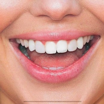 Brian J Hanratty, DDS - My smile thanks to Dr. Hanratty - General Dentistry Near Me - Pismo Beach, California Brian J Hanratty, DDS - My smile thanks to Dr. Hanratty - General Dentistry Near Me - Pismo Beach, California