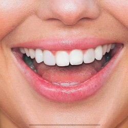 Brian J Hanratty, DDS - My smile thanks to Dr. Hanratty