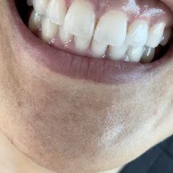 StoneCreek Dental - Vestavia Hills - Fixed by dentist at Hoover location