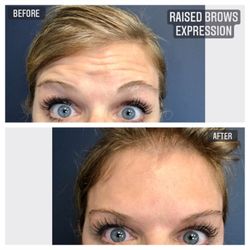 Get great results with our new client special of 20 units for only $189.
