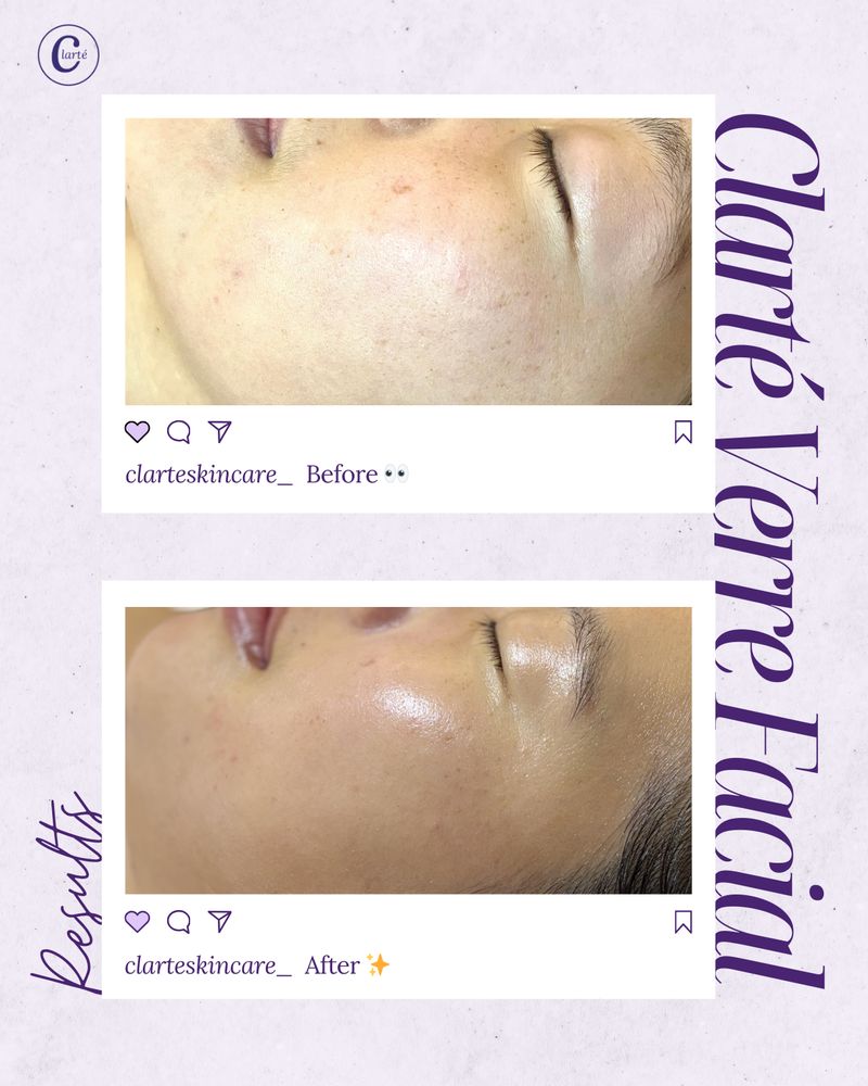 Clarte Skincare Logo