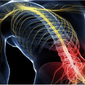 Sciatica Massage Center - Massage Therapy Near Me - Chicago, Illinois Sciatica Massage Center - Massage Therapy Near Me - Chicago, Illinois