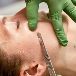 Flourish Aesthetics - Dermaplaning.