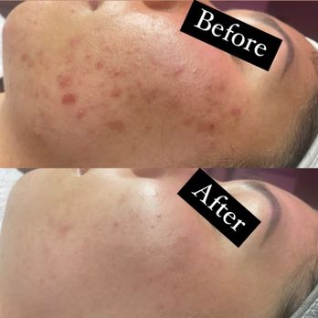 Traes Skin studio - Estheticians Near Me Traes Skin studio - Estheticians Near Me