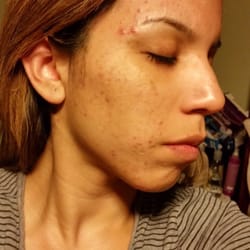 Dr. Jimmy Schmidt - My face before