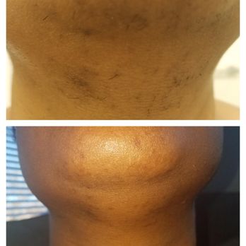 Vishka - Skin Care Near Me - Arlington, Virginia