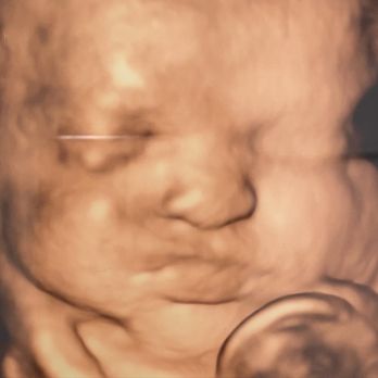 Take A Peek Boutique - Ultrasound Imaging Centers Near Me - Gilroy, California Take A Peek Boutique - Ultrasound Imaging Centers Near Me - Gilroy, California