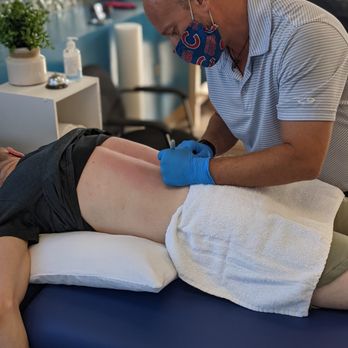 Act Now Physical Therapy and Concussion Management - Dry needling is a specialty that help relieve pain and reduce inflammation - Sports Medicine Near Me - Whiting, Indiana Act Now Physical Therapy and Concussion Management - Dry needling is a specialty that help relieve pain and reduce inflammation - Sports Medicine Near Me - Whiting, Indiana