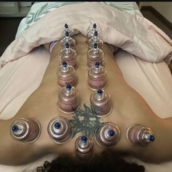 Allyvmassage - Cupping on the back