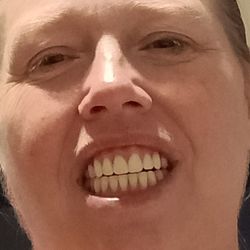 Affordable Dental - My horse teeth that the affordable dentist did cannot swallow cannot eat cannot wear went back three times I wish I never went there