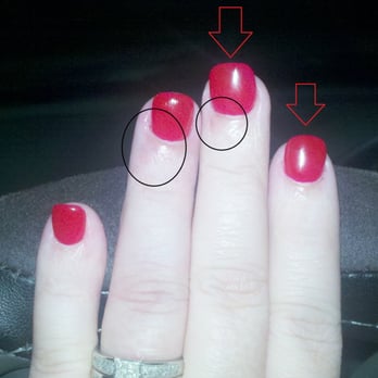 Nail Paradise - Circles are cuts, arrows show crooked nails - and no, my fingers aren't crooked. - Nail Salons Near Me - Beverly Hills, California Nail Paradise - Circles are cuts, arrows show crooked nails - and no, my fingers aren't crooked. - Nail Salons Near Me - Beverly Hills, California