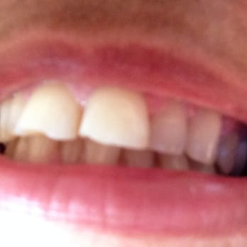 Robert Borowicz, DMD - Cosmetic Dentists Near Me - Jersey City, New Jersey Robert Borowicz, DMD - Cosmetic Dentists Near Me - Jersey City, New Jersey