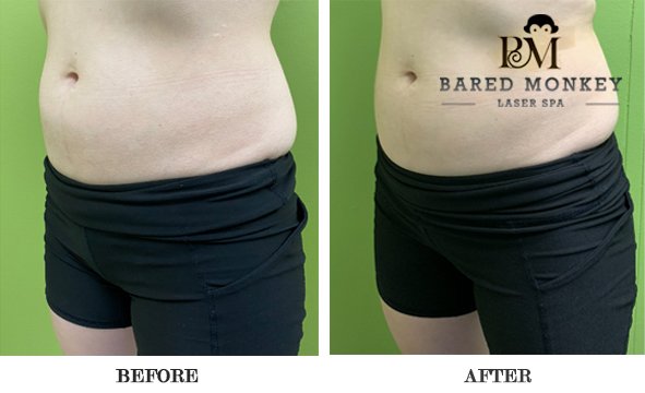 Bared Monkey Laser Spa by null