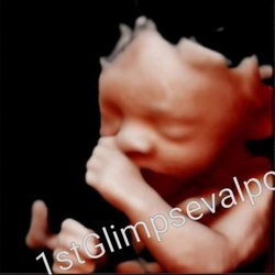1st Glimpse 3d 4d Ultrasound