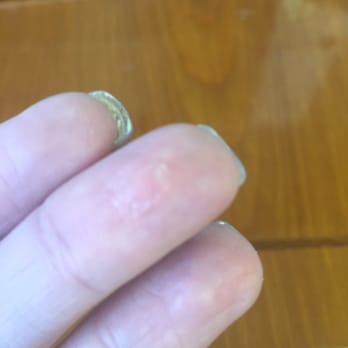 Mohegan Nail Spa - Nail glue on my finger. - Nail Salons Near Me - Omaha, Nebraska
