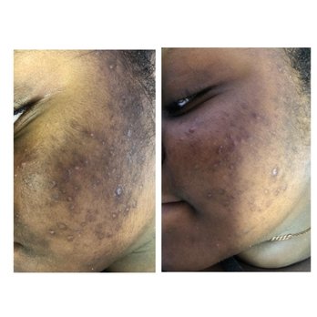 Peace Mind Beauty Day Spa - Before and after treatment - Day Spas Near Me - Troy, Michigan Peace Mind Beauty Day Spa - Before and after treatment - Day Spas Near Me - Troy, Michigan