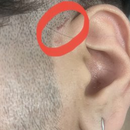 Tiny scab from the cut yesterday on 4/22/2021 by James. I understand people have bad days, bad cuts, but no courtesy. Tiny scab from the cut yesterday on 4/22/2021 by James. I understand people have bad days, bad cuts, but no courtesy.