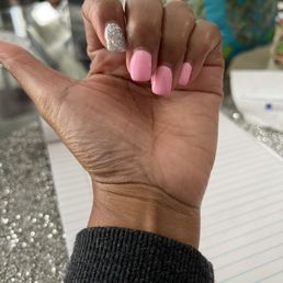 Middle finger nail is shaped crooked